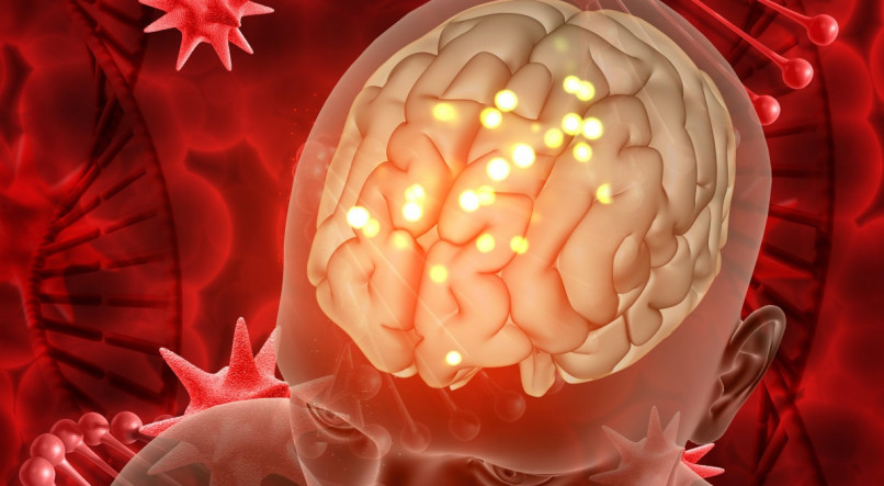 O aneurisma cerebral apresenta alta taxa de mortalidade
