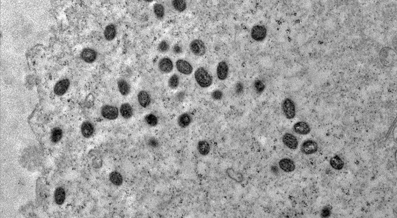 A varíola dos macacos é transmitida pelo vírus monkeypox, que pertence ao gênero orthopoxvirus