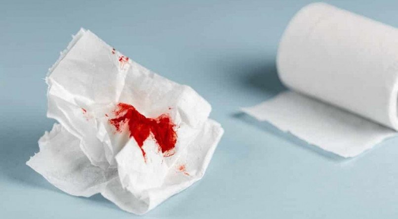 Sangue nas fezes