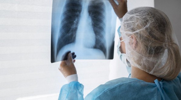 consumo excessivo de álcool, tabagismo, falta de atividade física, histórico de pólipos no cólon e certas condições médicas, como doença inflamatória intestinal.