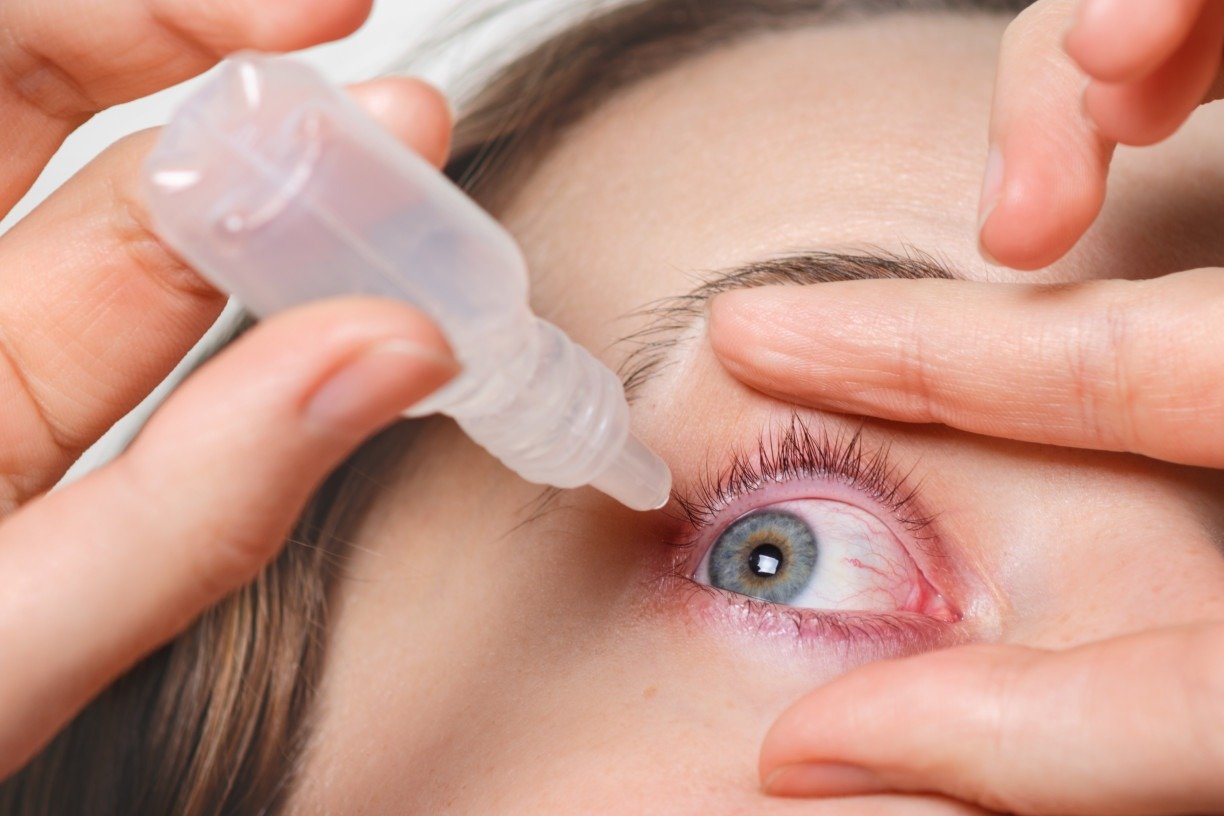 glaucoma