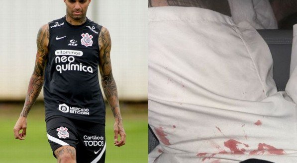 Luan Guilherme publicou foto mostrando roupa ensanguentada após agressão 