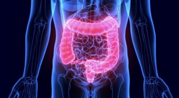 OBSTRUÇÃO INTESTINAL: O que é obstrução intestinal? Veja 5 SINTOMAS para ficar de ALERTA da obstrução intestinal