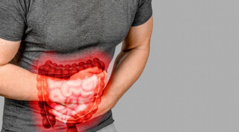 O câncer de intestino tem alta incidência na nossa população