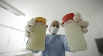 Leite materno extraído deve ser armazenado em frascos de vidro com tampa plástica previamente esterilizados