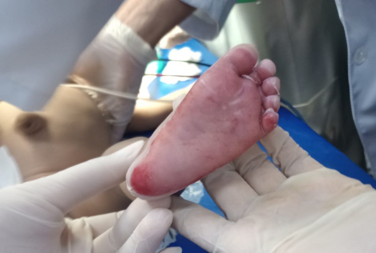 A bebê teria diversas lesões no corpo, como queimaduras no pé e pescoço, além de hematoma no olho direito e inchaço na cabeça