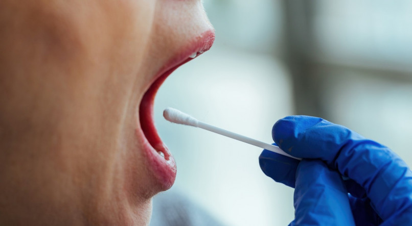 Veja os principais sintomas do câncer de boca