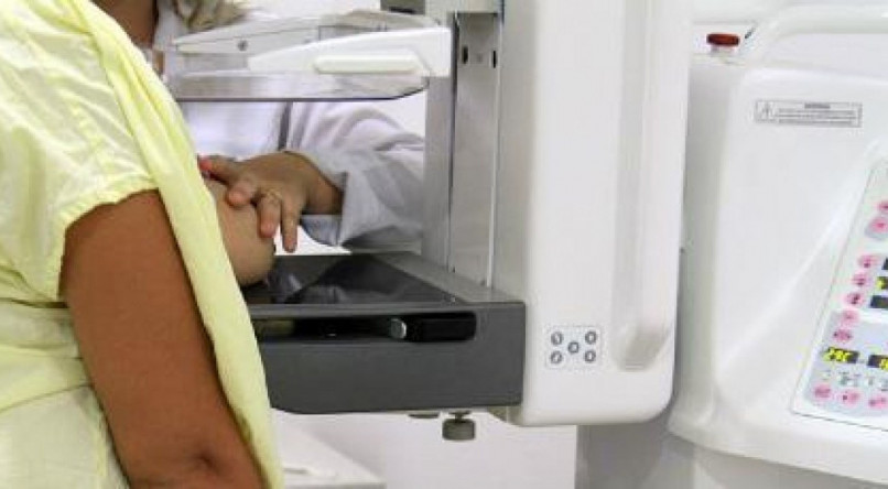 A mamografia pode ser considerada o raio-x da mama. &Eacute; a principal forma de detec&ccedil;&atilde;o precoce do c&acirc;ncer de mama na atualidade 
