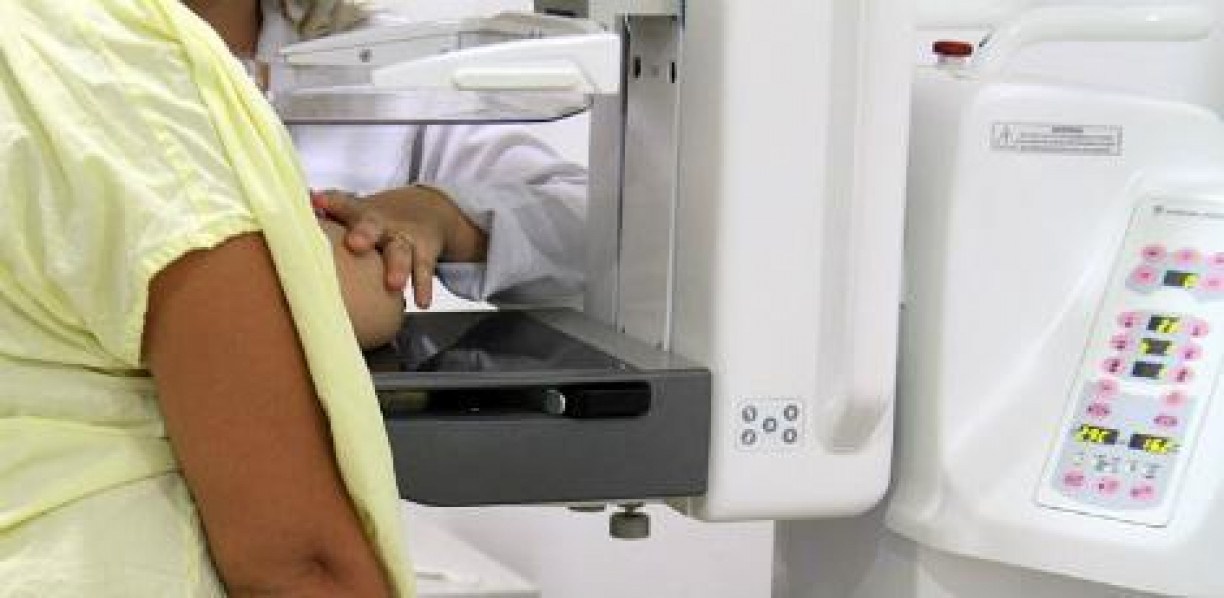 A mamografia pode ser considerada o raio-x da mama. É a principal forma de detecção precoce do câncer de mama na atualidade 