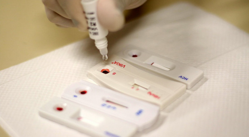 Centros de Testagem realizam teste laboratorial de hepatite B, hepatite C, HIV e sífilis