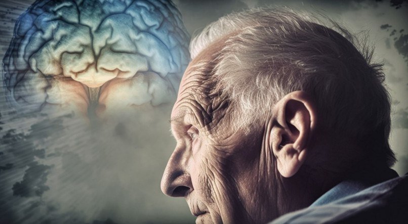 Alzheimer