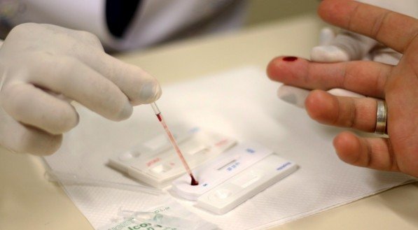 Caso estejam fora da validade, esses insumos podem ser ineficazes na detec&ccedil;&atilde;o do HIV e resultar em um exame falso negativo