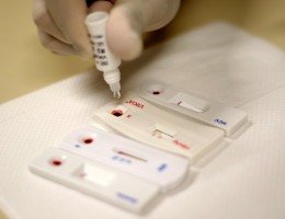 Foram detectados, 125 casos reagentes para sífilis; 10 para HIV; 4 para hepatite C e 3 para hepatite B