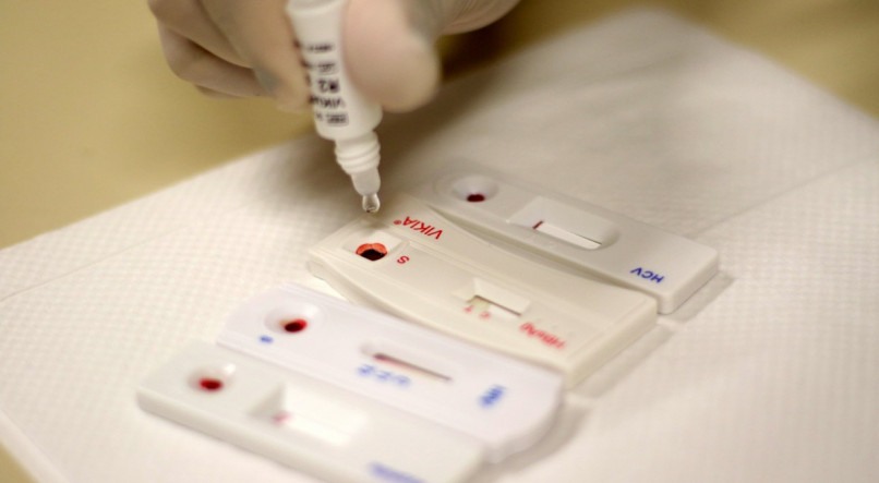 Foram detectados, 125 casos reagentes para sífilis; 10 para HIV; 4 para hepatite C e 3 para hepatite B