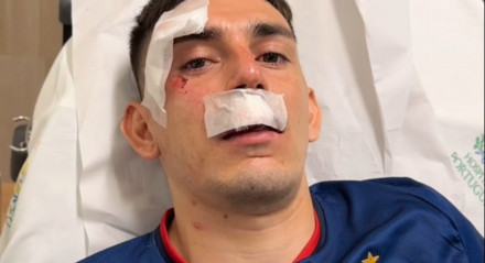 Gonzalo Escobar sofreu ferimentos após ônibus do Fortaleza ser atacado por torcida uniformizada do Sport