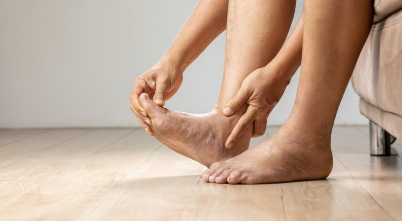 Imagem ilustrativa de pés inchado