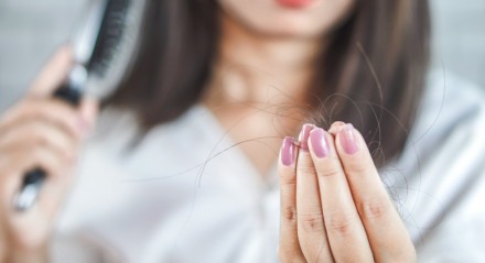 Imagem de mulher segurando fios de cabelo que caíram ao penteá-los