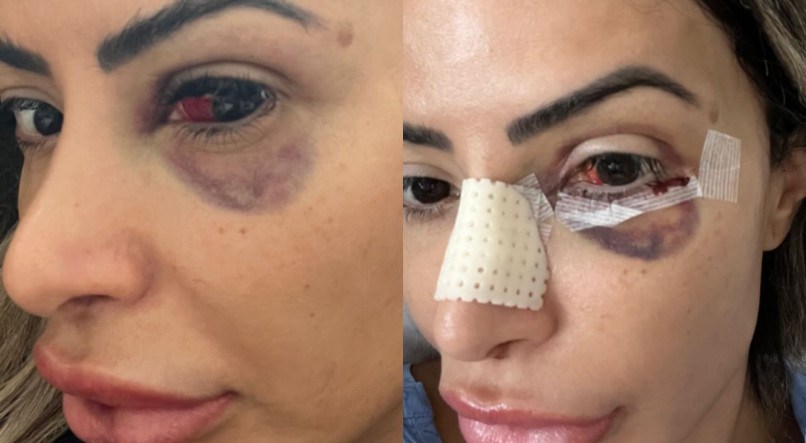 Fotos da influenciadora Janaína Prazeres após agressões
