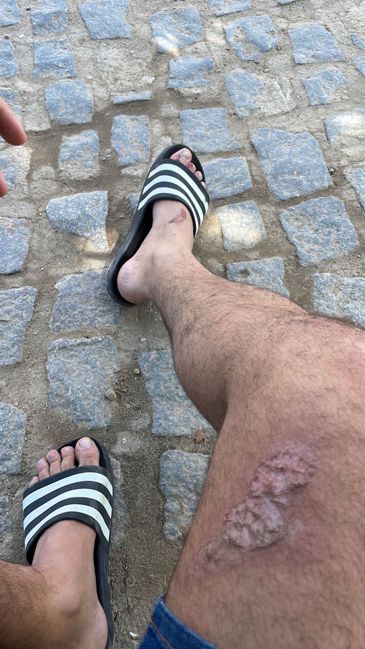 Acervo pessoal