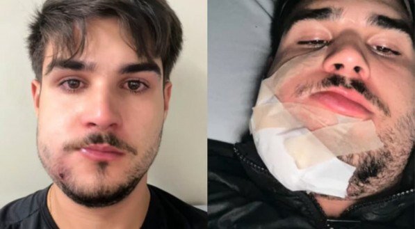 Imagem do tiktok do jovem após a cirurgia