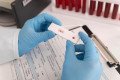 Transplante com HIV