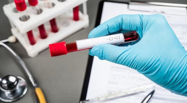 Imagem ilustrativa de um exame de sangue