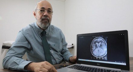 O neurocirurgião Antônio Marco destaca que, com o avanço tecnológico, é possível realizar o procedimento de forma mais confortável para o paciente 