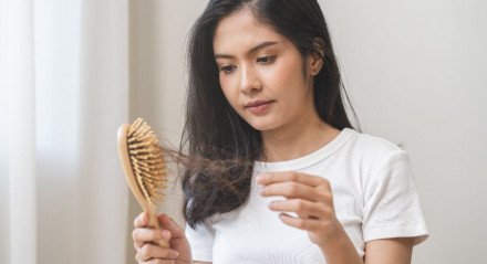 A queda de cabelo é um problema para muitas pessoas (Imagem: Kmpzzz | Shutterstock)