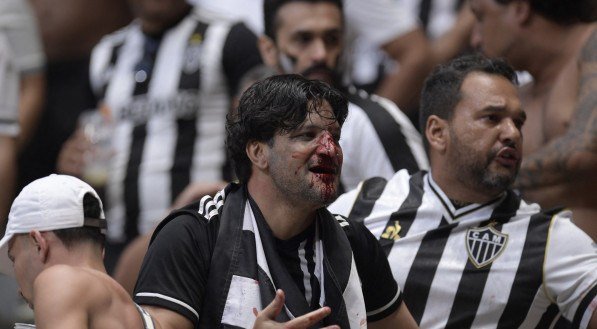 Imagem de torcedor do Atlético-MG sangrando na final da Copa do Brasil