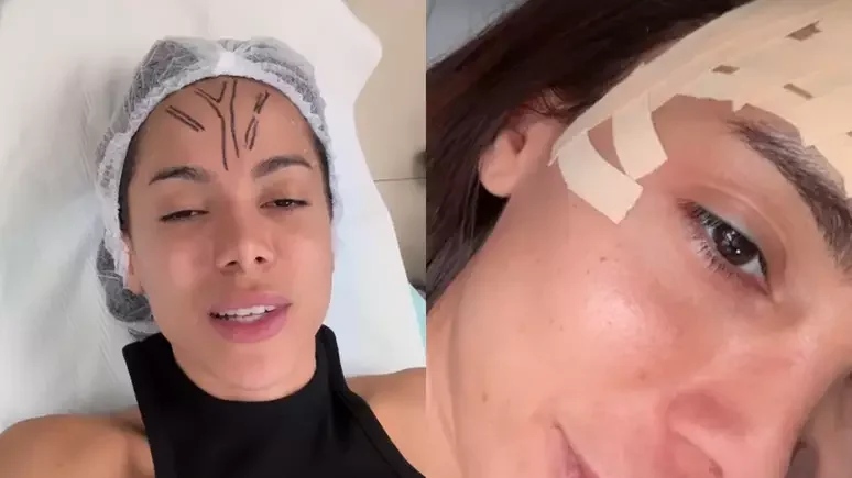 ANITTA