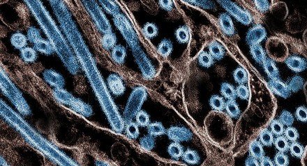 Em 2024, plataforma da Opas registrou 66 casos humanos de influenza aviária A(H5N1) confirmados nos Estados Unidos e um no Canadá