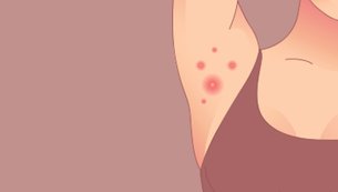 dermatologia