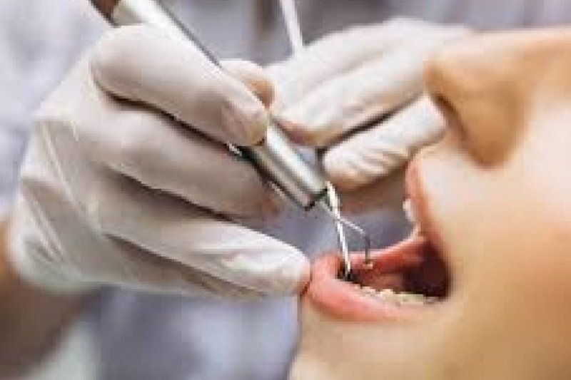 Dentista examinando uma boca
