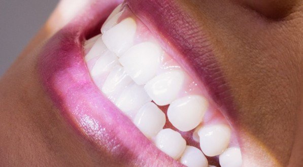 Significado de sonhar com dente caindo; veja o que quer dizer espiritualmente e na psicanálise
