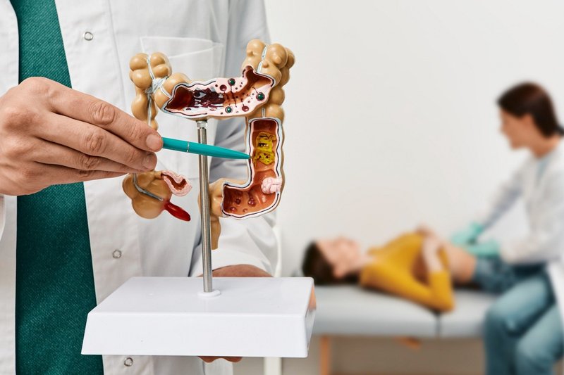 Exames como colonoscopia, endoscopia, exame de fezes, sangue e imagem ajudam a identificar inflamação e lesões intestinais