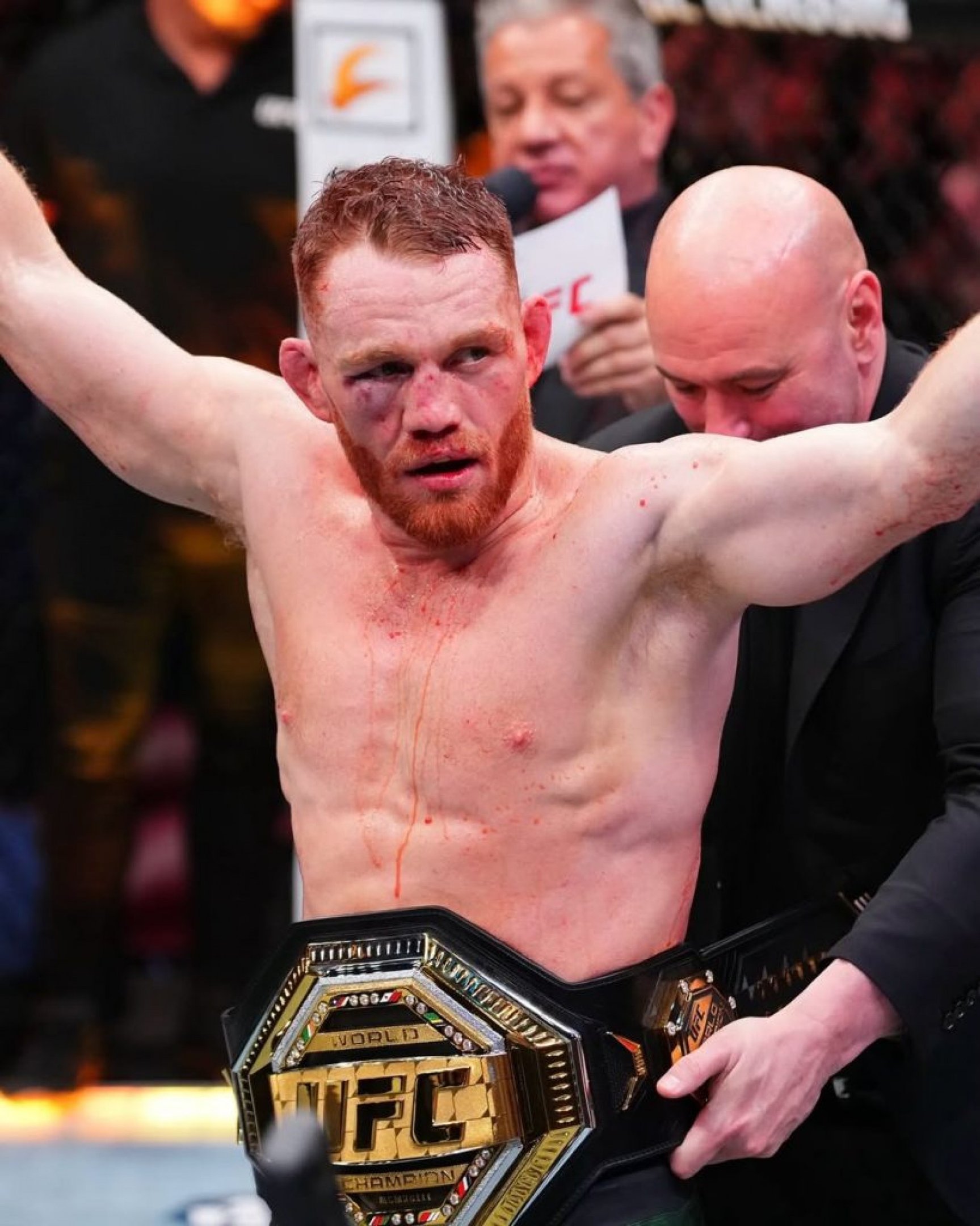 Jack Della Maddalena se consagrou como o novo campeão dos meio-médios do UFC ao derrotar no último sábado (11) Belal Muhammad na luta principal do UFC 315,