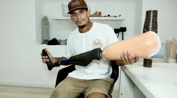 Imagem de Emmanuel Pedro Gonçalves Apory segurando prótese