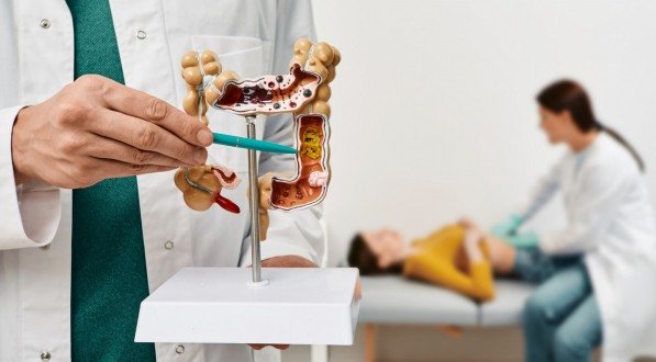 O diagnóstico de doenças intestinais deve ser realizado por profissionais de saúde habilitados