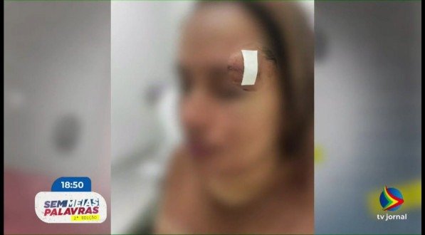 Imagem de mulher com ferimento no supercílio