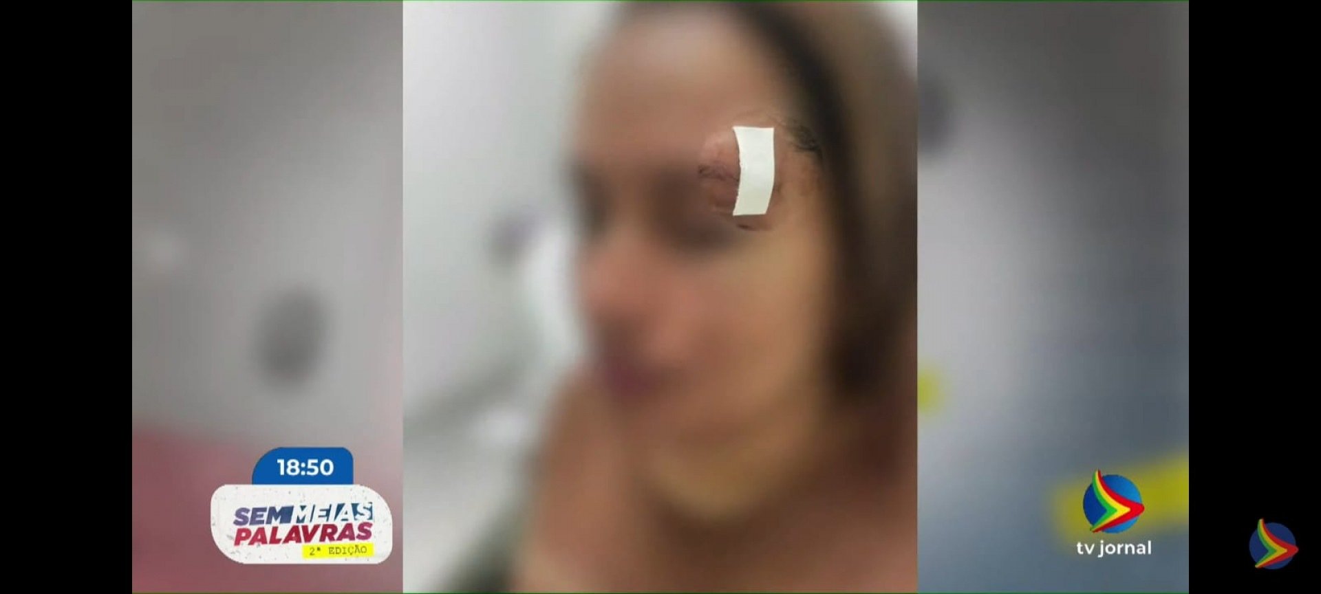 Imagem de mulher com ferimento no supercílio