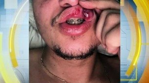Policiais Militares Acusados de Agressão Injusta Contra Comerciante Trabalhador em Jabotão: A Injustiça na Avenida dos Vencidos