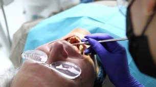 Imagem ilustrativa de um homem no dentista fazendo reparos