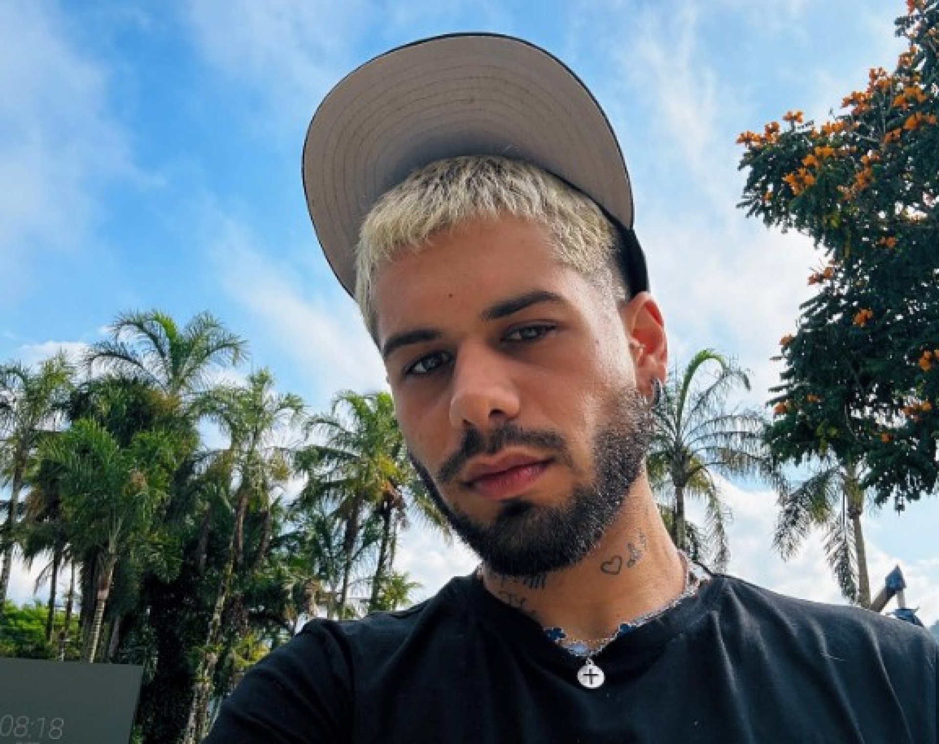 Zé Felipe sofre acidente doméstico após o banho e leva pontos: 