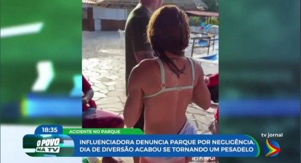 Imagem de vítima de acinete em parque aquático com ombro machucado