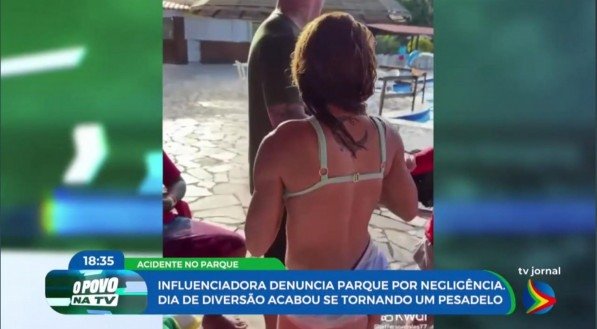 Imagem de vítima de acidente em parque aquático com ombro machucado