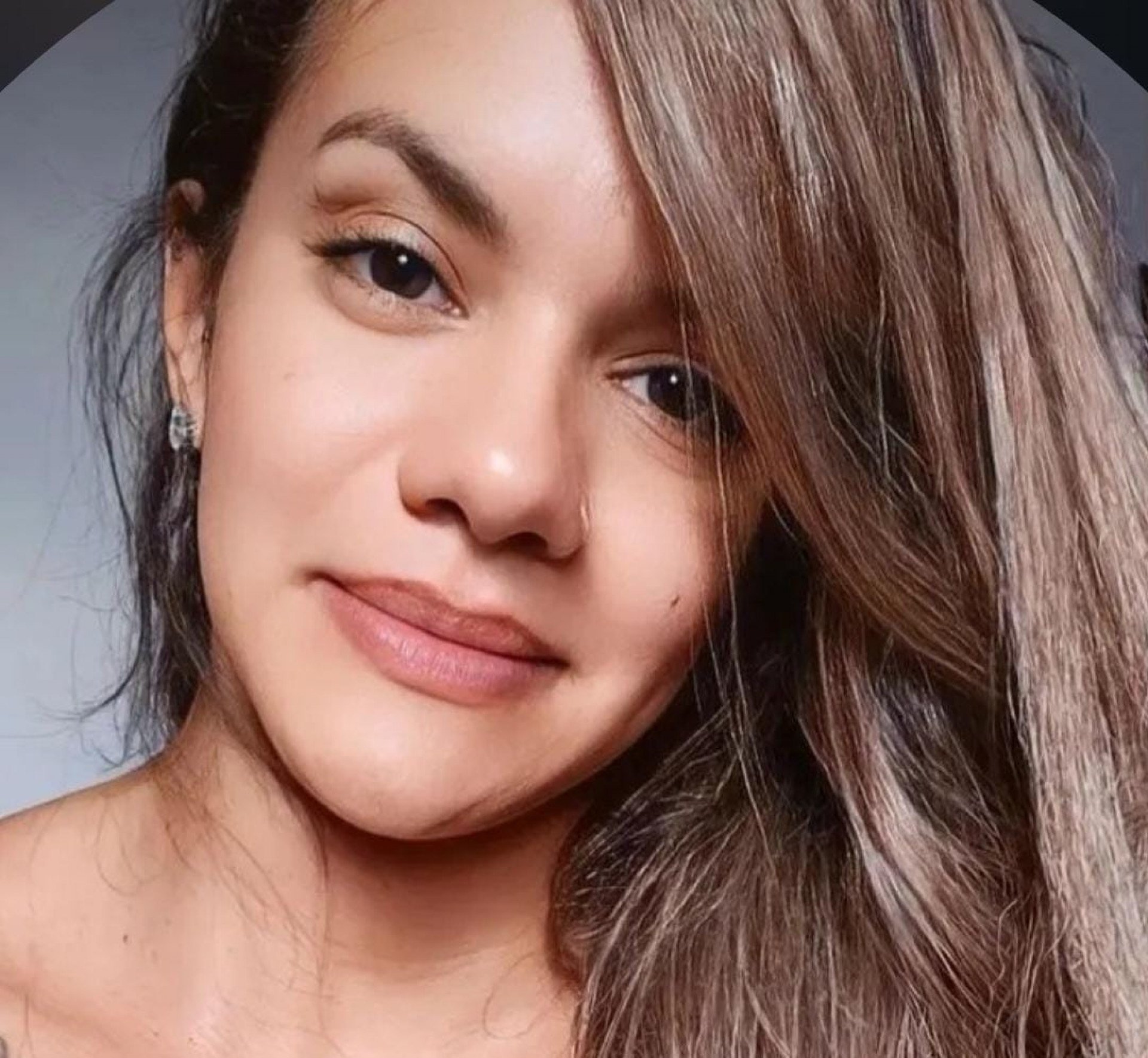 Mulher espancada no elevador já arrecadou mais de R$ 40 mil em vakinha online; saiba como ajudar