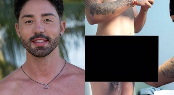 Rico Melquiades realiza harmonização peniana: “3 cm a mais”