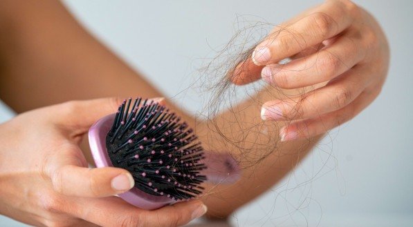Queda de cabelo