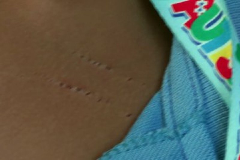 menino autista de oito anos alega agressão de professora em escola municipal de paulista: uma investigação urgente