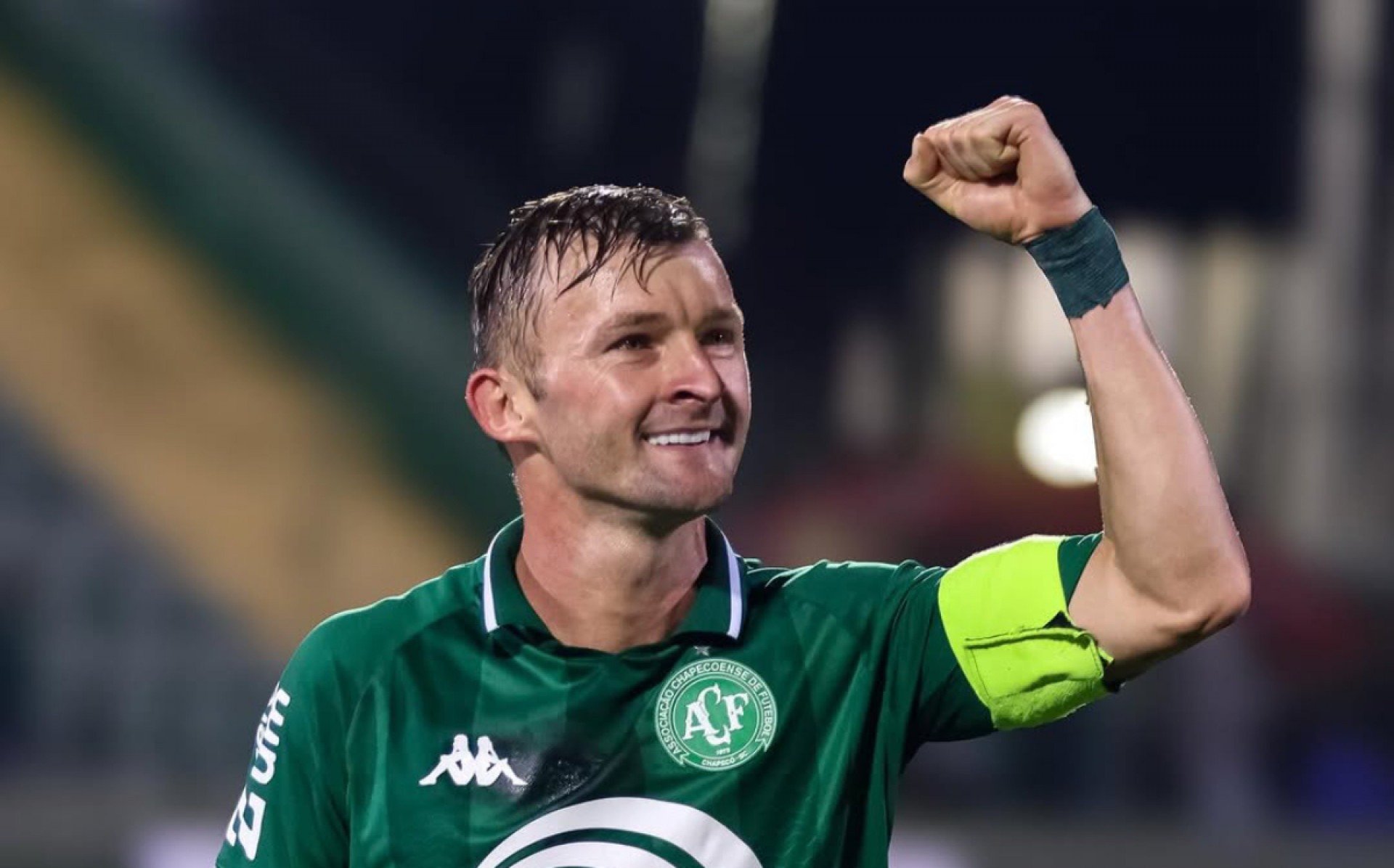 Chapecoense x América-MG: onde assistir ao vivo, horário e escalações